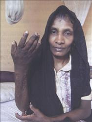 عاملة تعرضت للضرب في إحدى الدول المعنية بالتقرير