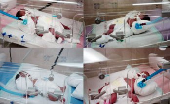 التوائم في مستشفى النبطية