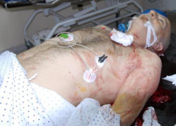 أحد ضحايا حادث زحلة