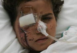 تموز 2006: فور نقلها إلى المستشفى