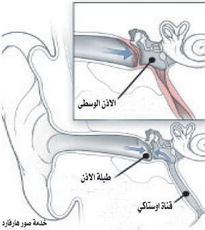 انسداد الأذن قد يحدث بسبب تراكم الشمع والخلل الوظيفي في القناة السمعية