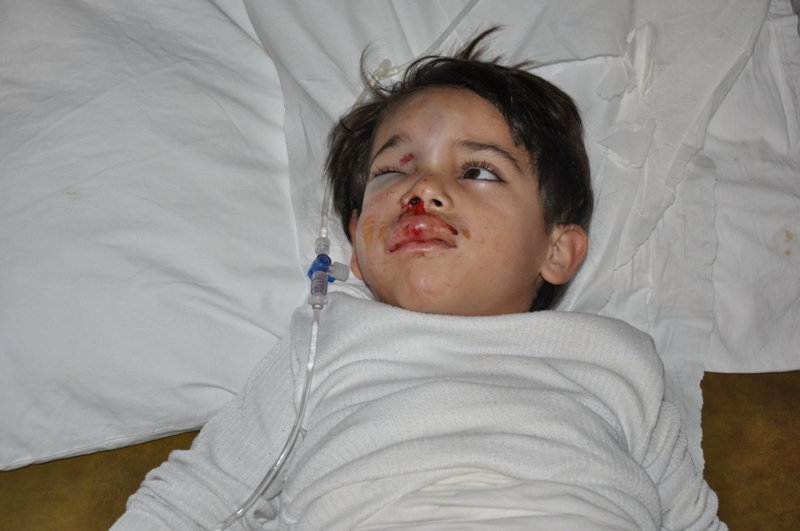 الجريح الفتي مهدي زريق