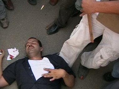 مصور إعتدى عليه البلطجية