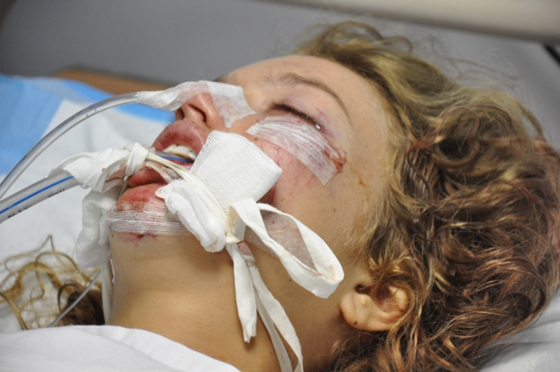 العداءة الكندية أورلي كوليت (24 عاما) في مستشفى النجدة الشعبية في النبطية