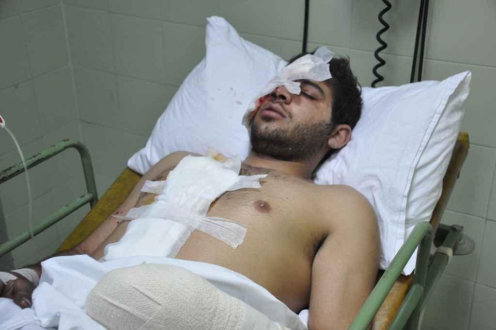 اصابة شاب من بلدة أنصار جراء انفجار قنبلة عنقودية من مخلفات العدوان