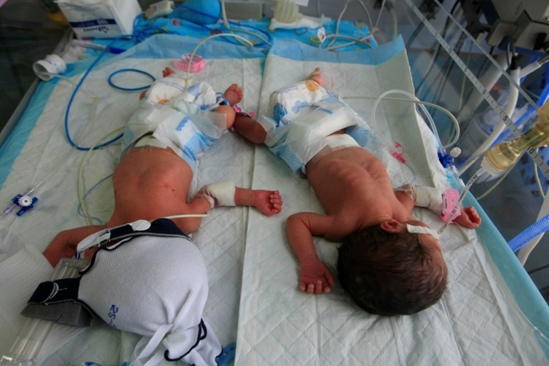 اثنان من التوائم