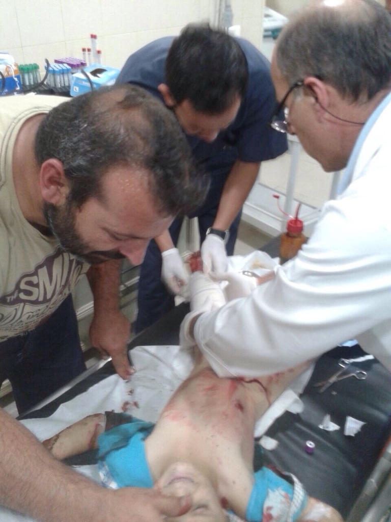 الاطباء في مستشفى تبنين يعالجون أحد الاطفال الجرحى