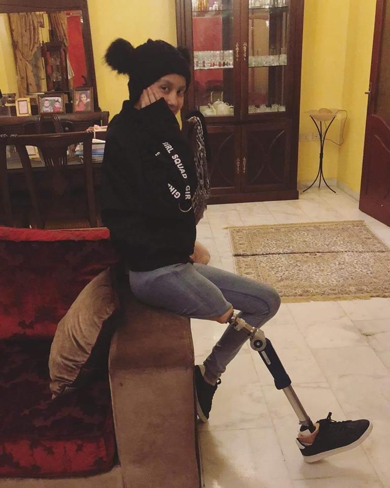 بُترت قدمها، ومع هذا لم تخجل من أن تستكمل حياتها بين الناس